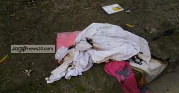 ছেলের দেওয়া আগুনে দগ্ধ পিতার মৃত্যু