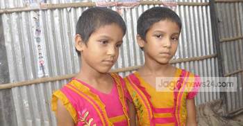 অস্ত্রোপচারে পৃথক হওয়া সেই দুই শিশু মনি-মুক্তার জন্মদিন আজ