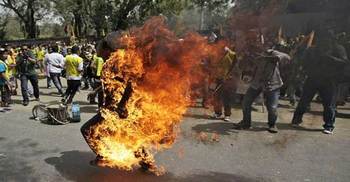 Teaser set him on fire, Hugged girl leaving her burnt