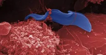 One drug is ‘new hope’ for three killers