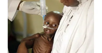 80,000 children will starve to death in Nigeria: UNICEF