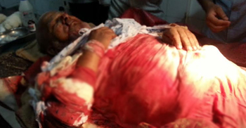 হাতিয়ায় দুর্বৃত্তদের হামলায় বণিক সমিতির সেক্রেটারি আহত