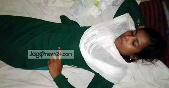 শরীয়তপুরে বখাটের হামলায় তিন ছাত্রীসহ আহত ৮