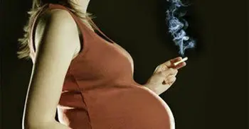 Smoking in pregnancy may make children obese