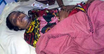 সাদুল্যাপুরে দুর্বৃত্তদের ছোড়া এসিডে মা-মেয়ে দগ্ধ