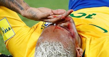 Neymar’s face covered in blood 