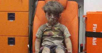 Photo of Syrian boy harmed in airstrike ‘manipulated’: Assad