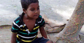 শিশু দেখলেই তেড়ে কামড়াতে আসে রাজন