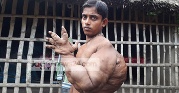 সাতক্ষীরার রাজীবও অজানা রোগে আক্রান্ত