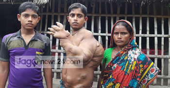 রাজীবকে দ্রুত ঢাকা পাঠাতে বললেন স্বাস্থ্য বিভাগের ডিজি