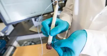 ‘Pen’ identifies cancer in 10 seconds