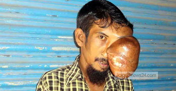 টিউমারের ব্যথায় কাজ করতে পারি না, তাই ভিক্ষা করি