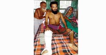 সহযোগিতা পেলে সুস্থ হয়ে যাবে আমার ছেলে