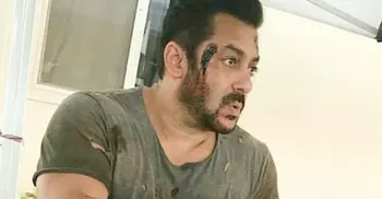 Salman Khan’s injured photos go viral on social media