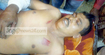 সন্ত্রাসীদের হামলায় হাসপাতালে ইউপি সদস্য