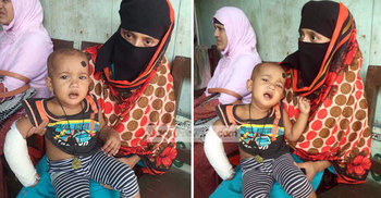 ভাঙা হাত রেখে ভালো হাত প্লাস্টার করল হাসপাতালের কর্মচারী