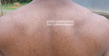 ১৫ বছর ধরে সহস্রাধিক মানুষের আর্সেনিকযুক্ত পানির ব্যবহার