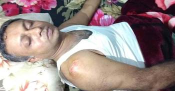 ফেনীতে বিএনপি প্রার্থীর গাড়িবহরে হামলার অভিযোগ