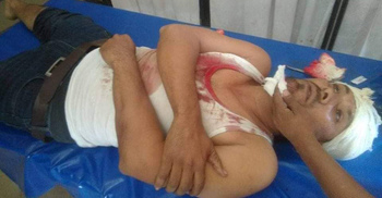 সাতক্ষীরায় বিএনপির প্রচারণায় হামলা, প্রার্থীসহ আহত ৬