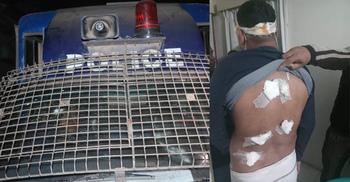 সিরাজগঞ্জে পুলিশ-বিএনপি সংঘর্ষ, প্রার্থীসহ আহত ২০