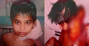 স্কুলছাত্র ইমরান এখন ক্যান্সারে আক্রান্ত