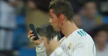 Ronaldo uses phone to inspect head injury