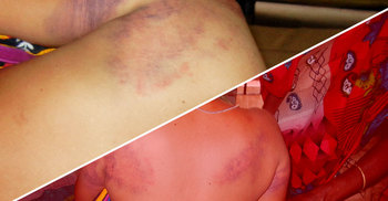 ‘আমার স্ত্রী অপরাধ করেছে তাই পিটিয়েছি’