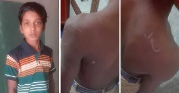Boy climbs down from 11th floor apartment building to save his life