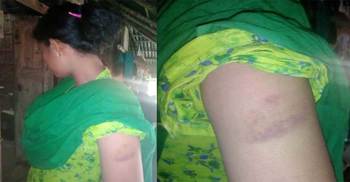 স্কুলে না যাওয়ায় দুই ছাত্রীকে পেটালেন প্রধান শিক্ষক