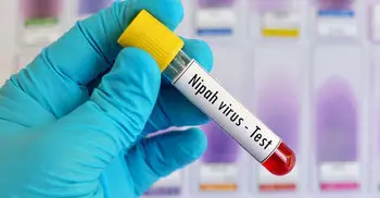 10 deaths in India due to Nipah virus symptoms