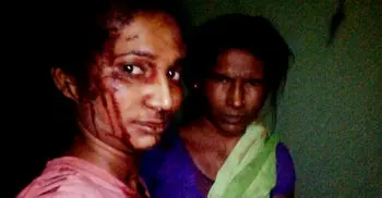 Indian woman Rupali fights off tiger with stick