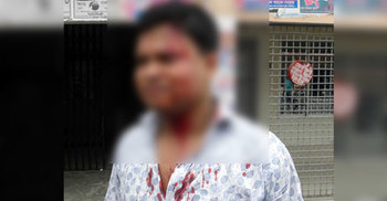 ভুয়া এতিমের বিল না দেয়ায় সমাজ সেবা কর্মকর্তাকে রক্তাক্ত
