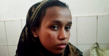 এসিড দিয়ে স্ত্রীর শরীরে নিজের নাম লিখে দিলেন স্বামী