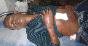 আদালতের গেটে মামলার বাদীকে ছুরিকাঘাত