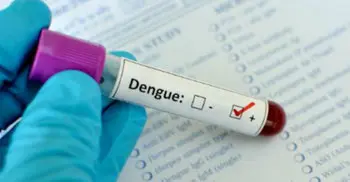 Charges for dengue tests fixed