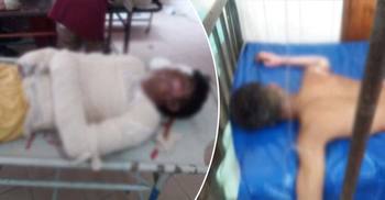 গ্রীনরোডে অফিস ডেকোরেশনের সময় হঠাৎ বিস্ফোরণ, ৪ শ্রমিক দগ্ধ