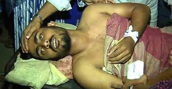 সোনাগাজীতে এবার যুবককে পুড়িয়ে হত্যার চেষ্টা