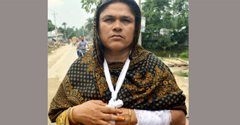 পিটিয়ে শিক্ষকের হাত-পা ভেঙে দিলেন সাবেক ইউপি সদস্য