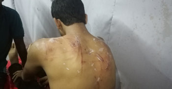 শ্রীপুর উপজেলা ছাত্রলীগ সভাপতির ওপর হামলা, আহত ৪