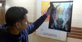 পেটের ভেতর ইয়াবা, ধরা পড়ল এক্স-রেতে