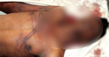 ফেনীতে গণপিটুনিতে ‘ডাকাতের’ মৃত্যু