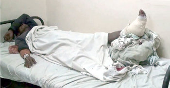 বন্দুকযুদ্ধের পর গুলিবিদ্ধ ডাকাত গ্রেফতার