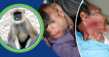 হনুমানের আক্রমণে ইউপি মেম্বারসহ আহত ৪