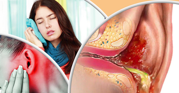 কানে ইনফেকশন লক্ষণ ও সারানোর ঘরোয়া উপায়