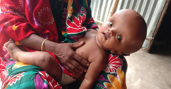 অস্বাভাবিক আকার ধারণ করছে আম্বিয়ার মাথা