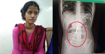 পেটে কাঁচি রেখেই অপারেশন সম্পন্ন, ফরিদপুরে তোলপাড়