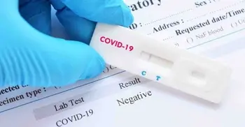 1,000 samples of corona suspects to be tested by Friday: DGHS