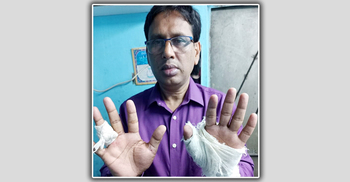 নোয়াখালীতে কারাগার থেকে বেরিয়ে শিক্ষা কর্মকর্তাকে হাতুড়িপেটা