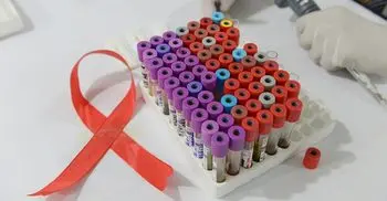 HIV vaccine trial ends in ‘deep disappointment’