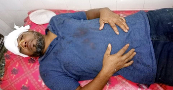 ফেসবুক স্ট্যাটাসে কমেন্ট করায় আ.লীগ নেতাকে পিটিয়ে জখম